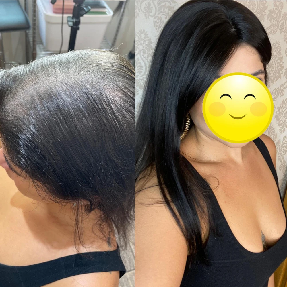 Human Hair Topper With 4 Clips In Silk Top Skin Base Virgin European Hair Toupee for White Women Hairpiece