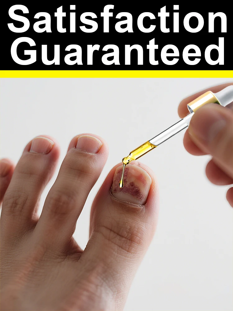 2025 أظافر الفطريات التصحيح مقاوم للماء مسمار إصلاح بقع مسمار نام تصحيح ملصق تغير لون التالفة مسمار أداة العناية بالقدم
