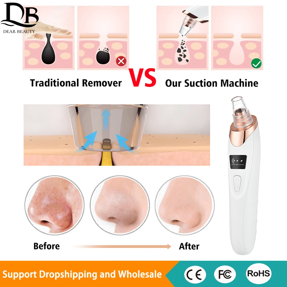 Odkurzacz do zaskórników, elektryczny, ładowany przez USB, do czyszczenia porów twarzy, usuwania komedonów, wyprysków, trądziku i zaskórników.