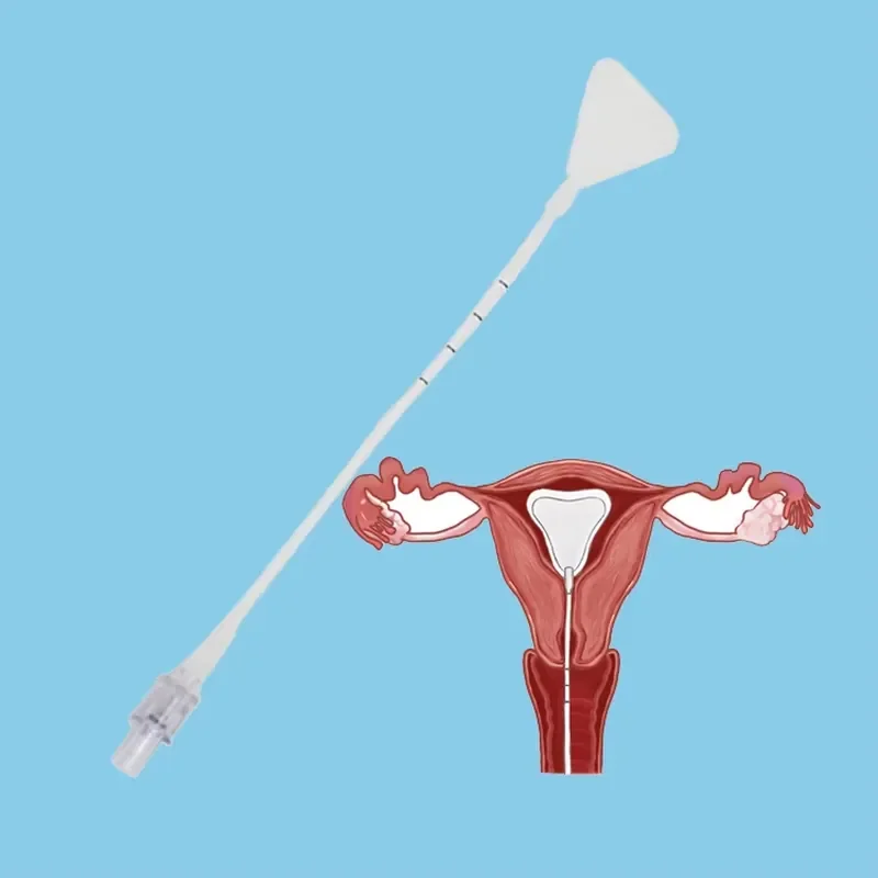 Seemine Intrauterine Balloon Uterine Stent PC Silicone Paper PE Materials for Placement Following Procedure
