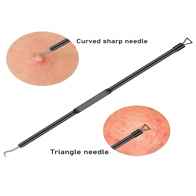 4ピース黒ずみ除去ツールセット - ステンレス製毛穴クリーナー、スキンケアツール、ディープクレンジングニードルフックニキビ除去ツール