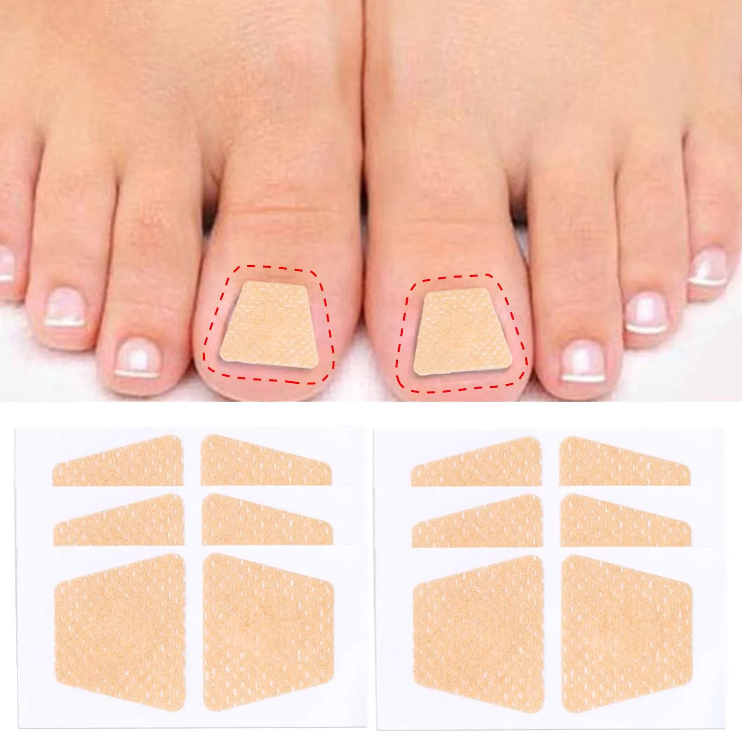 10/100Pcs Nail Treatment Patch Anti Fungal Nail Correction Sticker Ingrown Toenail Care Paronychia Anti Infection Repair Patch