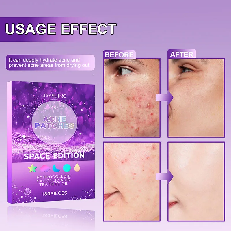 180Pcs Lightens Body Facial Acne & Pimples Closing Repair Balance Delicate Skin Pore Care Blemishes and Zits Cover Acne Patch