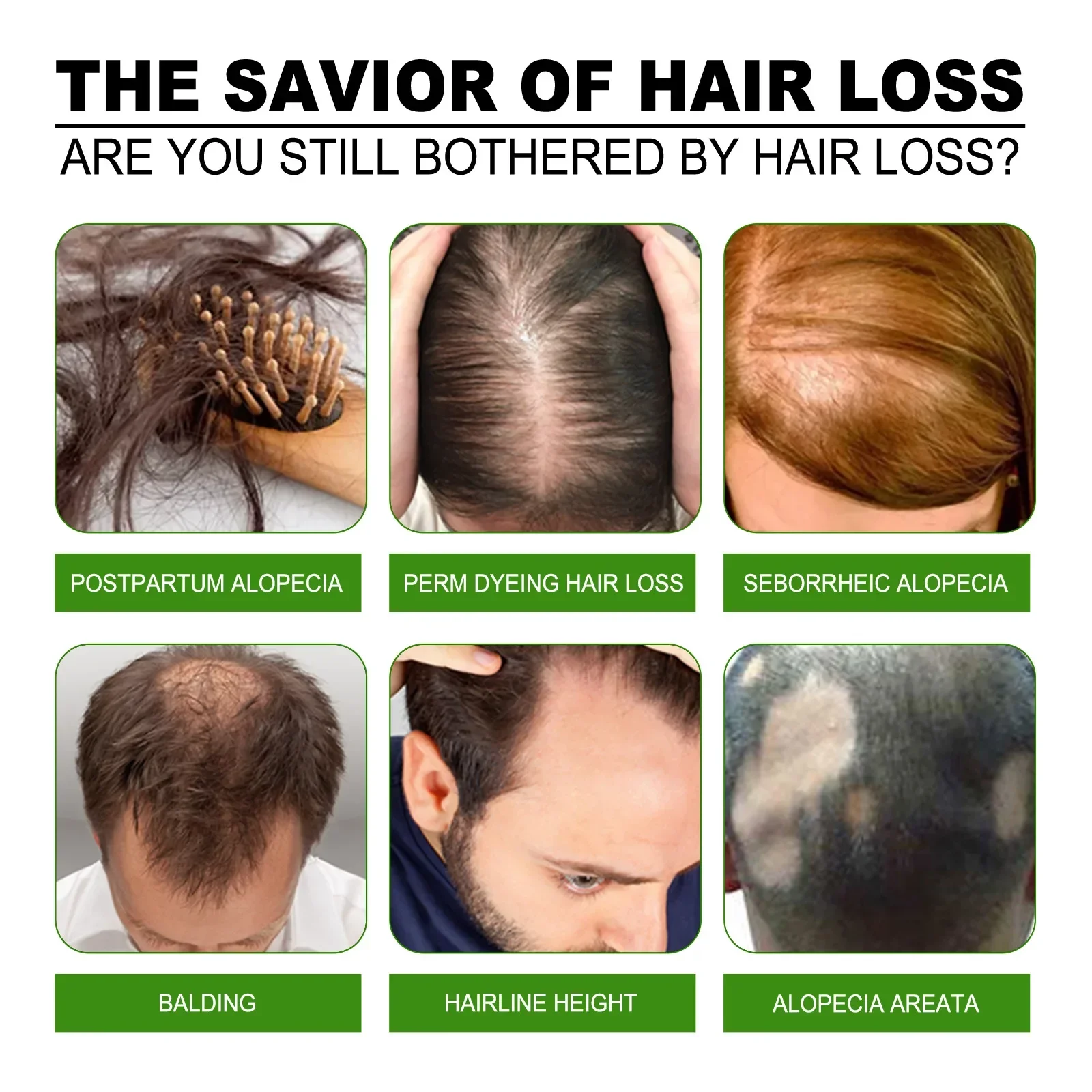 

Sdottor Anti falling dense hair essence scalp care firm dense hair repair hair root thick nutrition strong