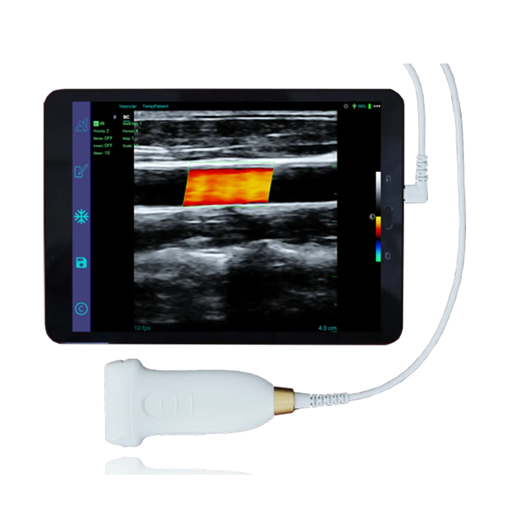 

Amain MagiQ MCUL10-5E Color Doppler Portable Handy Handheld USB Ultrasound Slide Scanner for Smart Phone