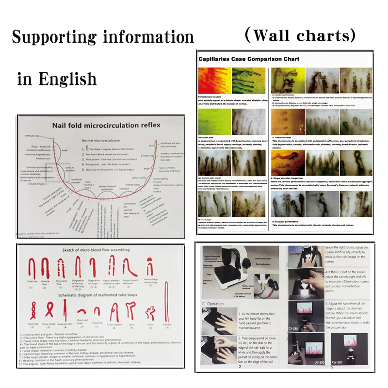 Portable nail wall capillary microcirculation detector, blood vessel microcirculation analyzer 7/8/9/10.1 LCD display