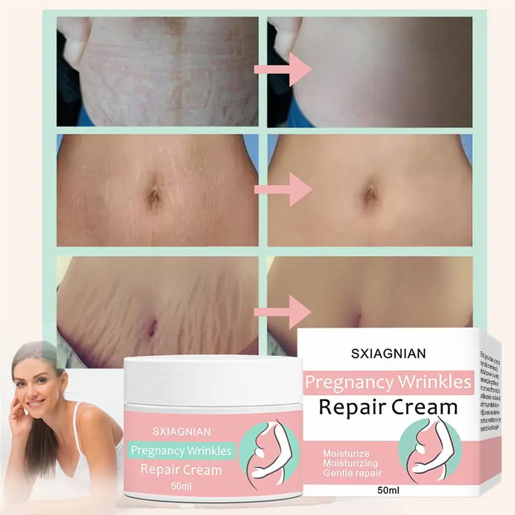 Women Stretch Mark Cream Pregnancy Wrinkles Comfortable Beauty Tools Safe Scars Remover Home Waist Body Care Supplies