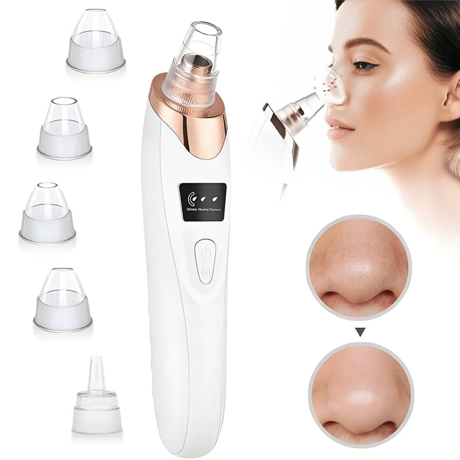 

NEUZOJIT Blackhead Pore Removal Vacuum, Facial Pore Cleanser - 5 Suctions, 5 Probes, USB Rechargeable Blackhead Vacuum Kit, Acne Removal Tool For Adults. Suitable For Bathrooms. Bedchamber. Holiday Gifts For Female Friends And Female Classmates In Places
