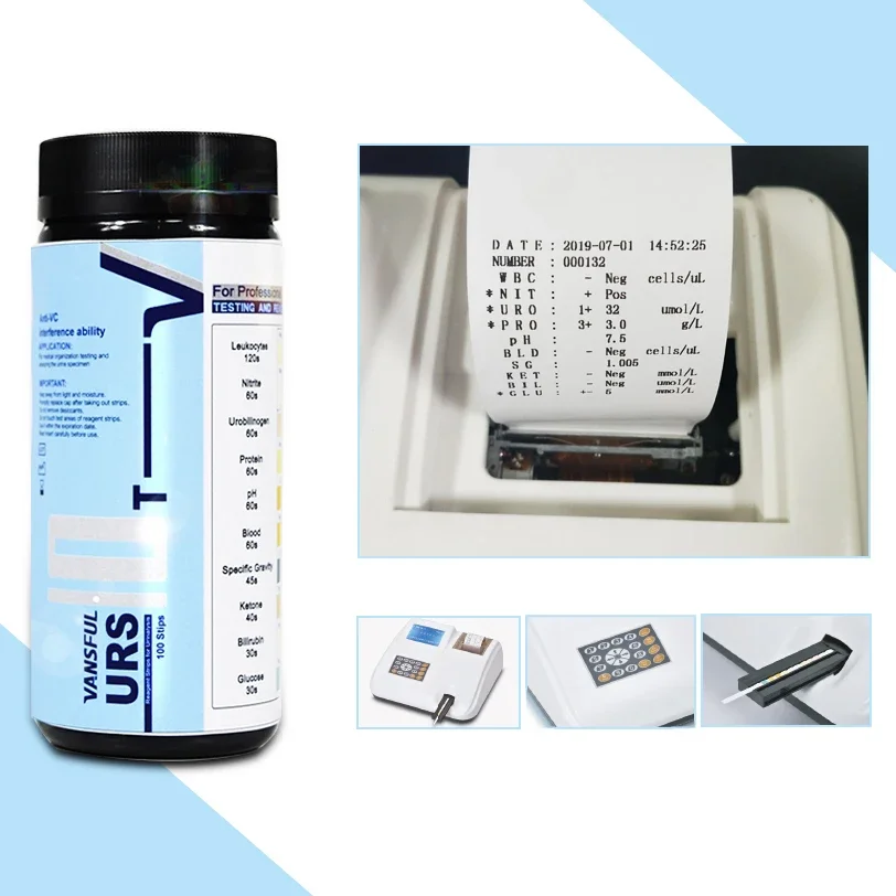 Hot Selling Product automated multi function urine analyzer strips machine Urine test equipment