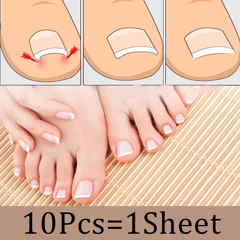 10pcs Ingrown Paronychia Toenail Corrector Strips Anti Nail Patch Feet Sleeping Nail Patch Nails into the Flesh Long Toe Pad image 2