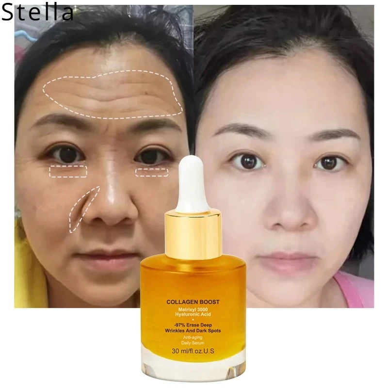 

Beauty Cream for Women Facial Essence Lighten Fine Lines Darkening Whit&ening Moisturizing Facial Skin Care Brightening Essence