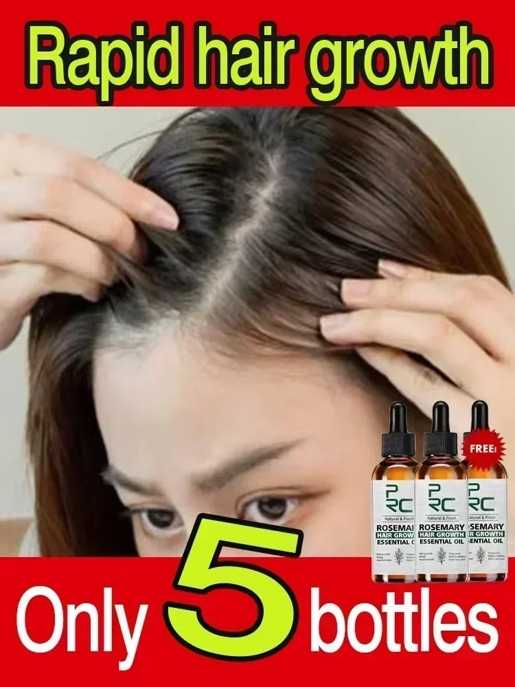 Biotin Fast Hair Growth Oil Hair Regrowth Serum aHair Thinning Treatment aHair Growth Liquid Anti-Hair Loss Baldness Serum