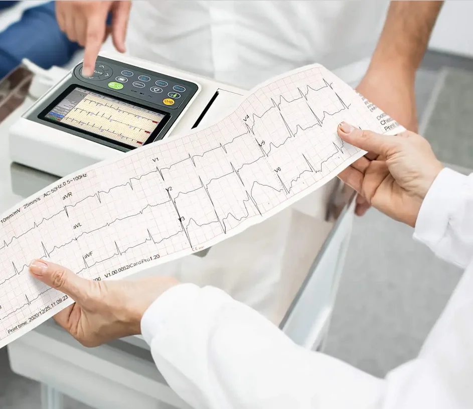 LONSANCO 10 لفات من ورق ECG لآلة تخطيط القلب ذات 3 قنوات، تناسب Edan SE-300، SE-3، SE-301، CONTEC ECG300G، ECG-600G