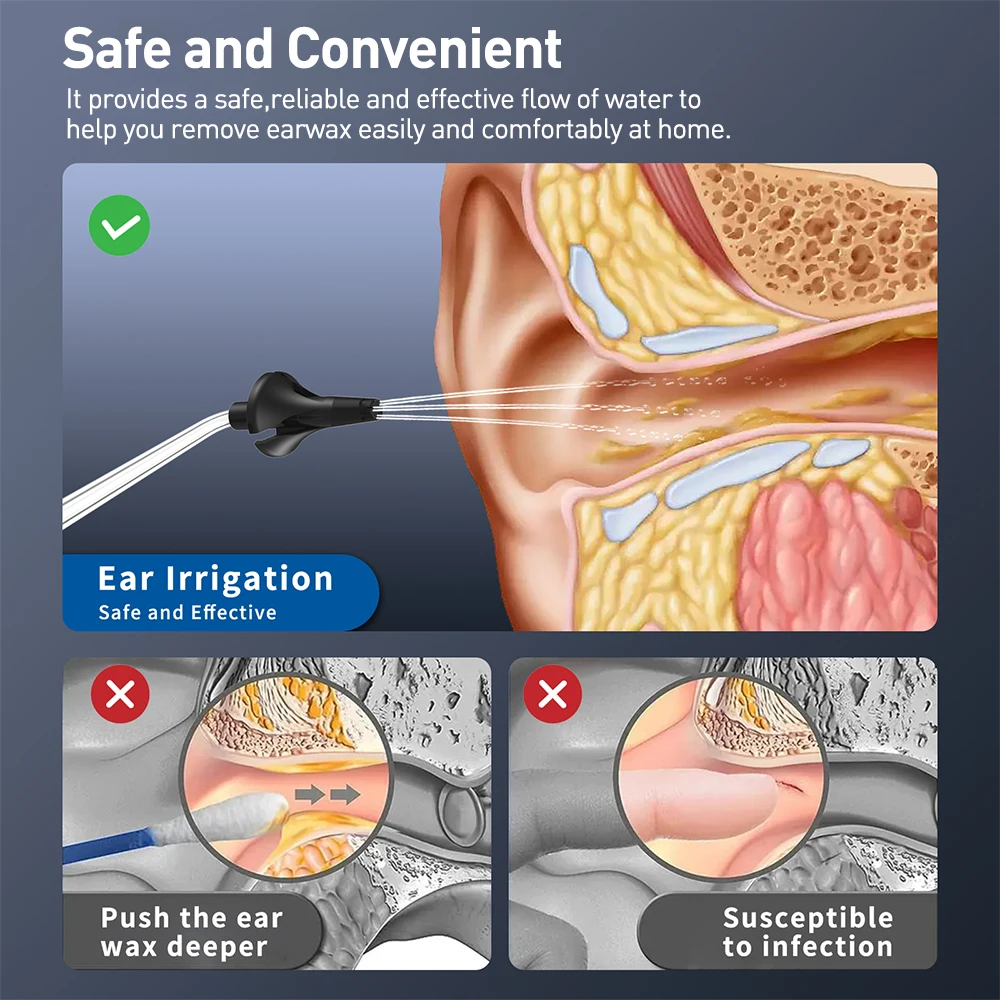 Homasy-limpiador de oídos eléctrico para adultos y niños, Kit de eliminación de cera de oído, sistema de lavado de irrigación del oído impermeable IPX7, 9 modos de presión