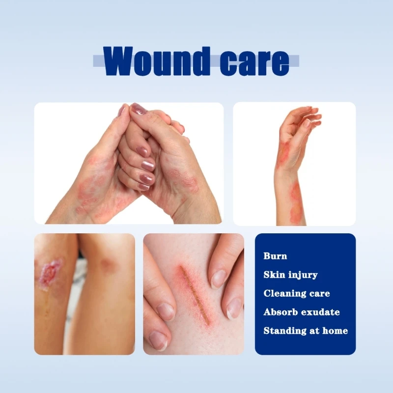 Stop Bleeding Gauze Blood Clotting Bandages Hemostatic Dressing Gauze D5QD