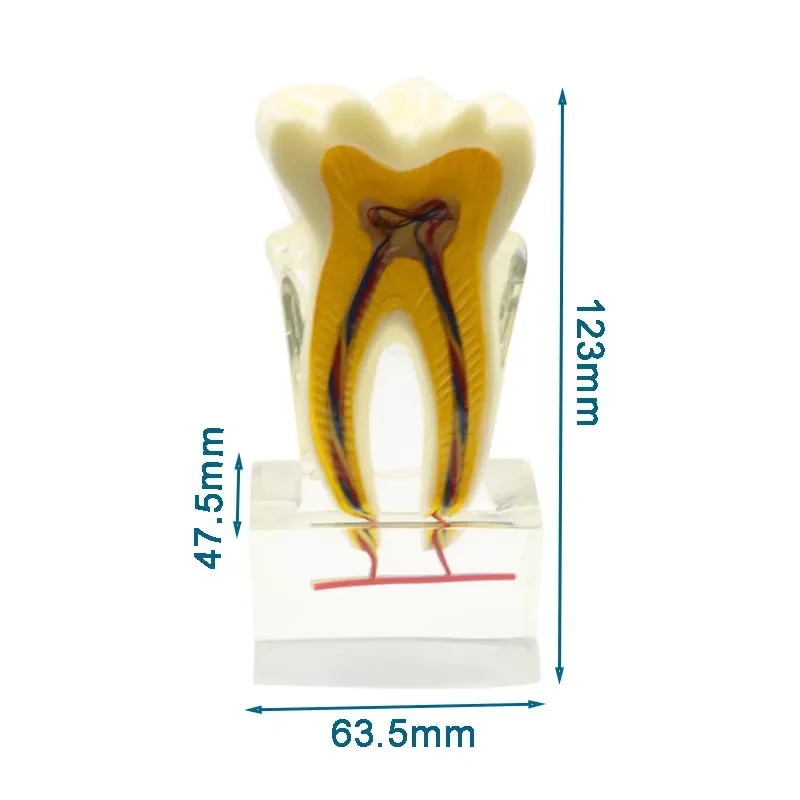 

Orthodontic Teeth Model Teeth Nerve Anatomical Dissection Demonstration Dentist Student Teaching Learning Model Dental Materials