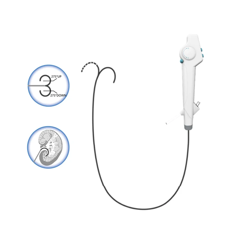 

Urology Single Use Digital Video Flexible Ureteroscope Price Disposable Portable Ureteroscope