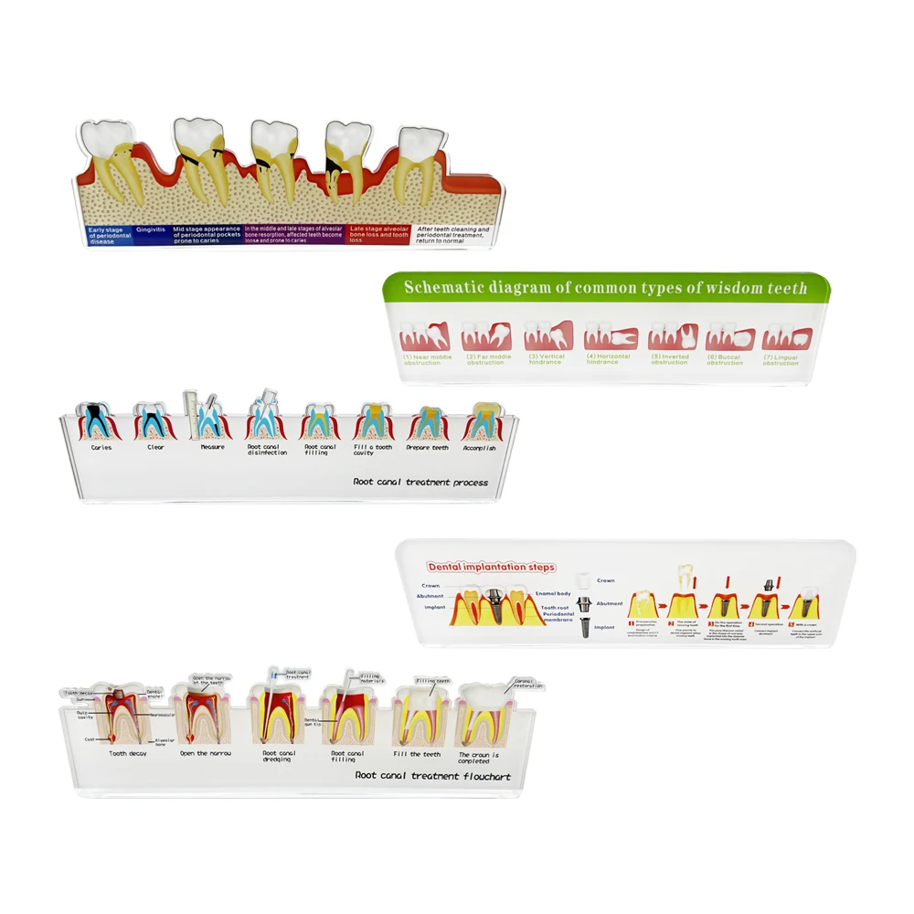 Dentystyczny schemat blokowy leczenia endodontycznego stojak kanał korzeniowy Model zębów badania dentysty Model nauczania dekoracji kliniki