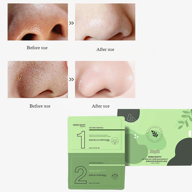 Tea Tree Cleansing Blackhead Removal Nasal Mask Combination Blackhead Removal Gentle Export Shrinkage Pore Nasal Patch Skincare