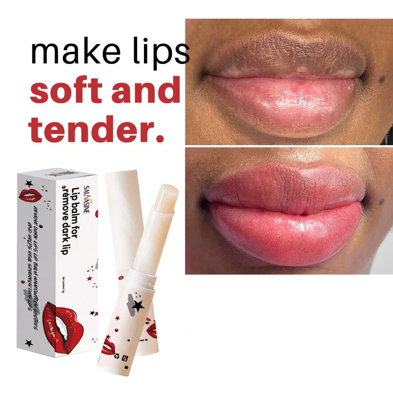 

Lips Pink Fresh Lightening Bleaching Cream Treatment Remove Dark Smoke Lips Essence Lips Bleaching whitening Lip Balm