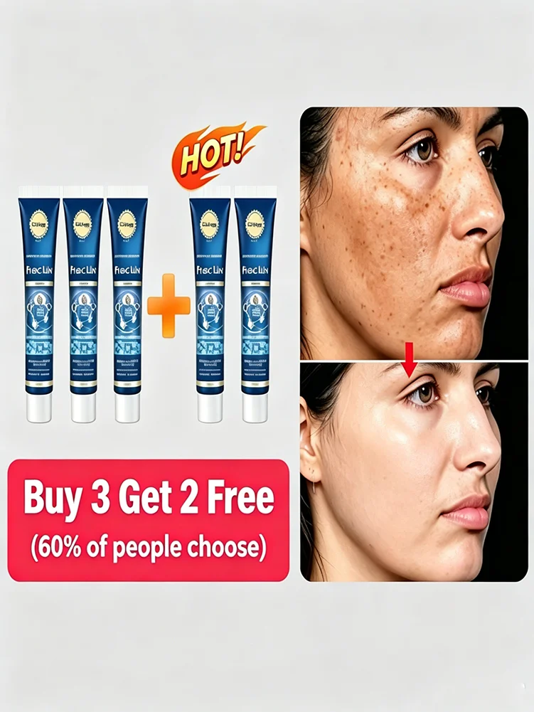 

Flash Sale! Nicotinamide Whitening Cream | Fast Melasma & Freckle Remover