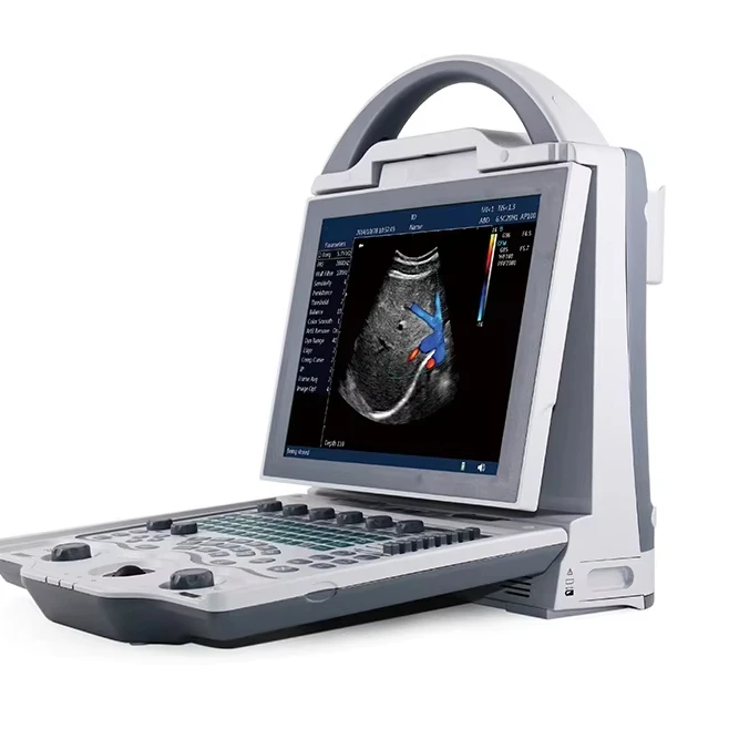 

portable 4d ultrasound for Medical diagnostic imaging center using