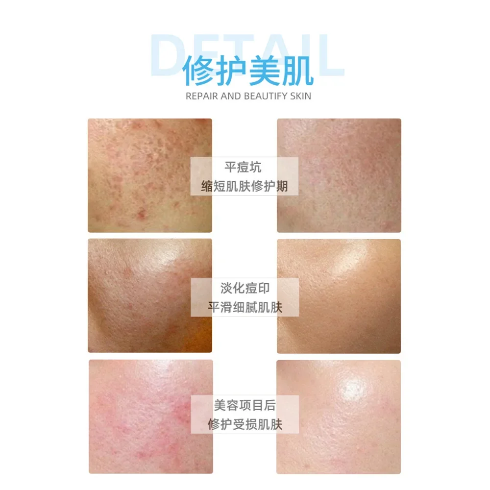 Oligopeptide-1 محلول مخزون مصل الوجه عامل نمو البشرة إصلاح الجلد سطع تقليل فرط التصبغ أمبولات العناية بالبشرة