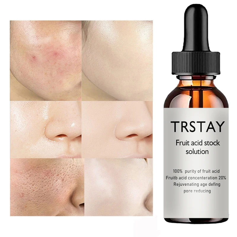 glycolic acid oil facial essence reduces fine lines, tightens skin, and improves damaged skin