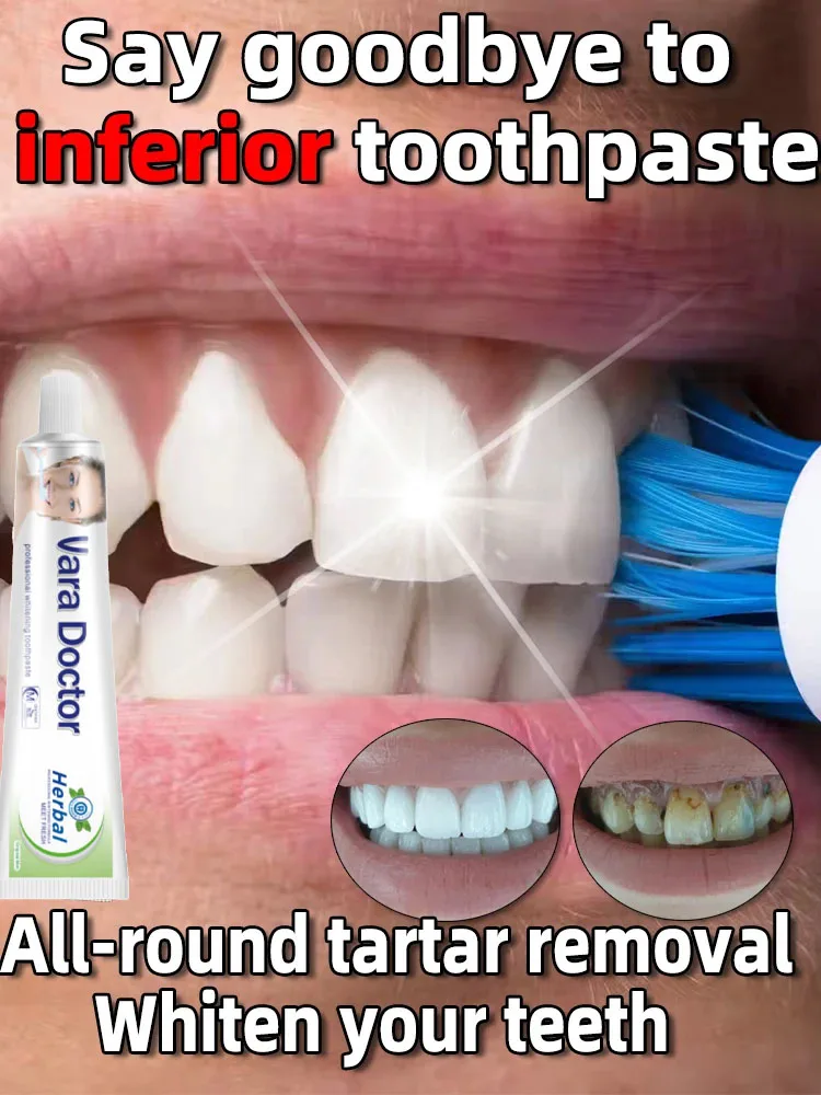 100g Whitening Toothpaste Remover Dental Calculus Whitening Teeth Mouth Odor Removal Bad Breath Preventing Periodontitis