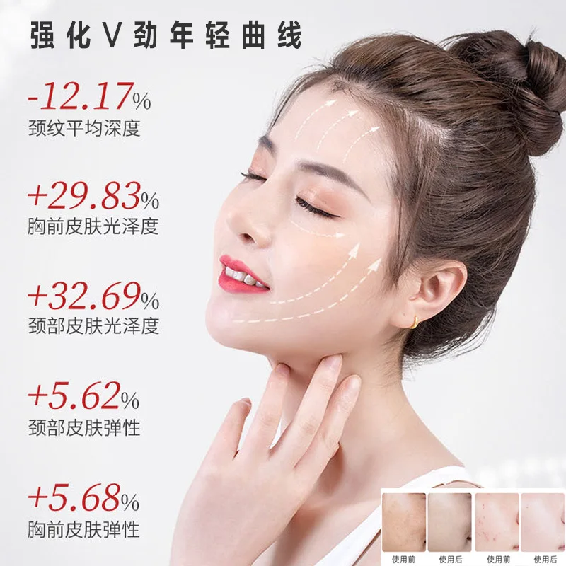Silicone LED neck mask (listing 5810), view 3