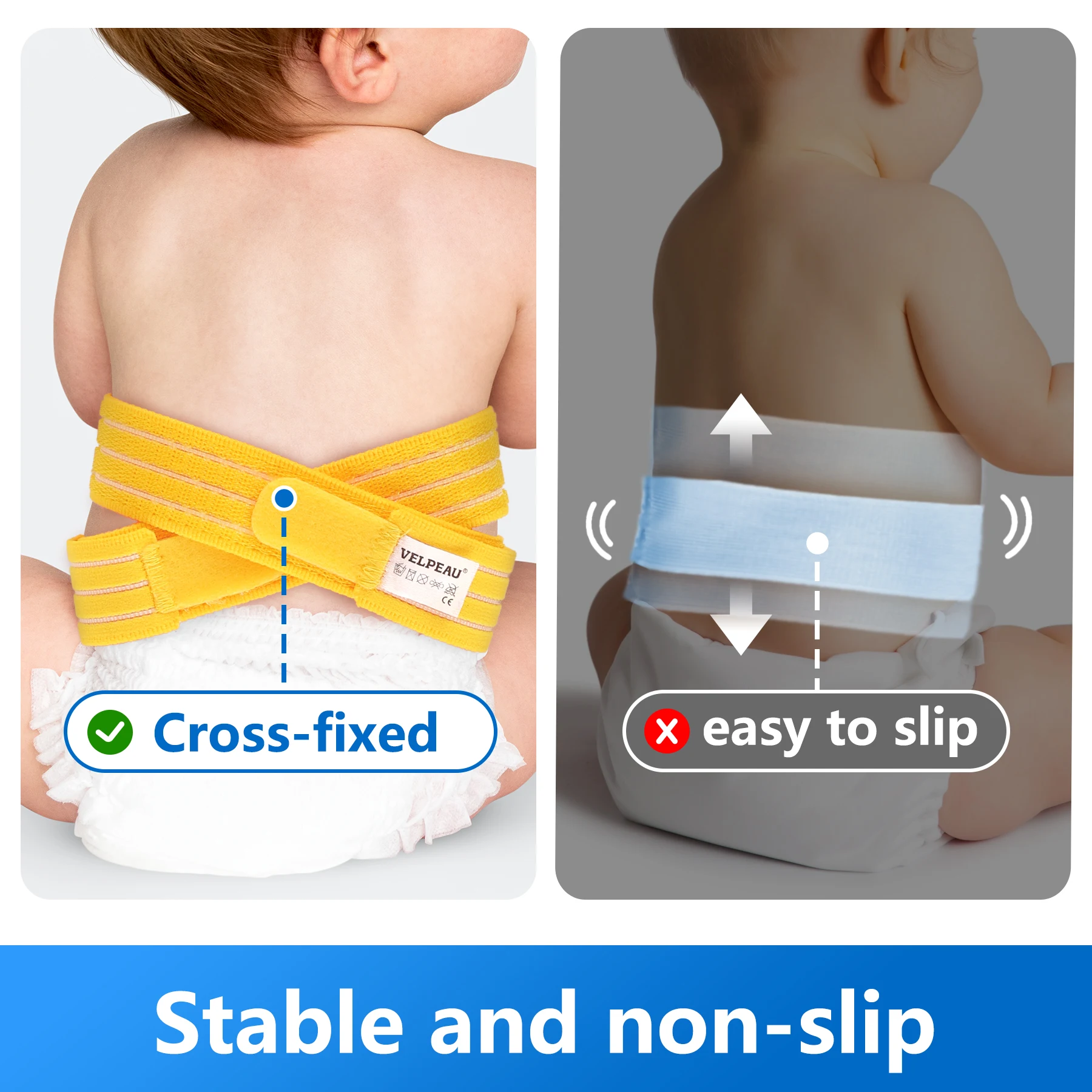 VELEPAU Umbilical Hernia Belt for Baby Abdominal Binder Support with 3 Compress Pads Belly Button Navel Band for Infant Kids