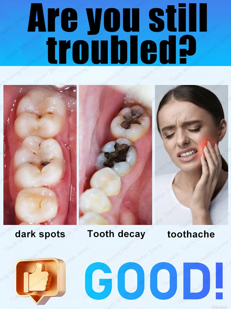 Thumbnail 2 - #34 New Dentures Arrivals