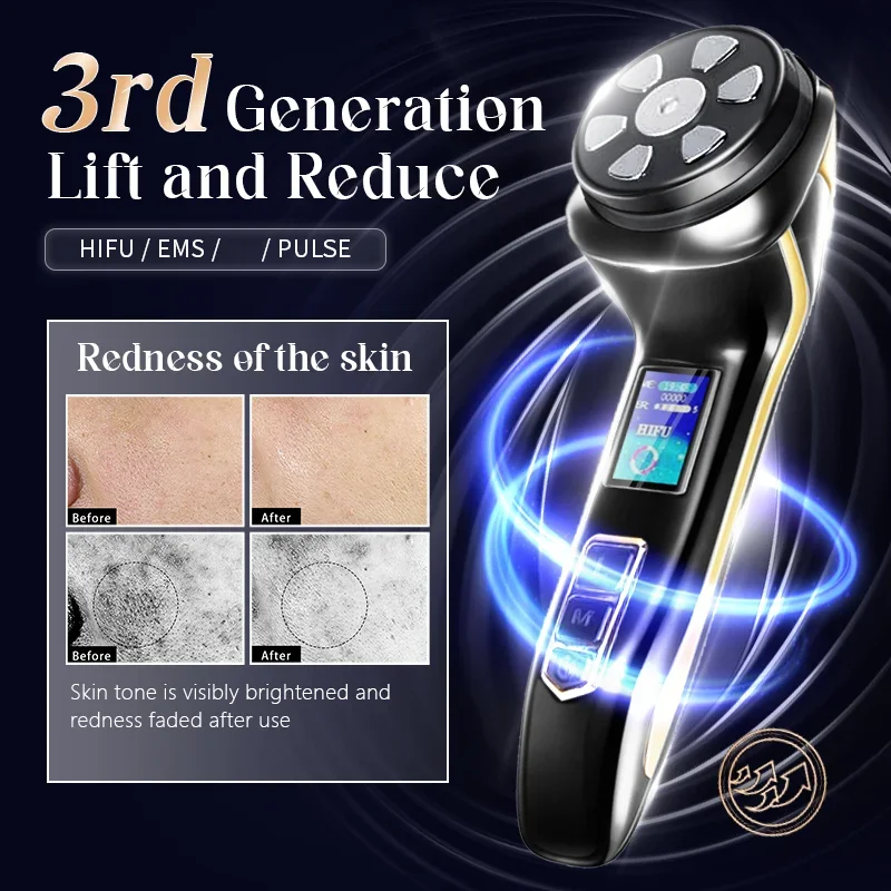 Thumbnail 3 - #30 Top 40 Acne Treatments & Kits Worth Buying In 2026