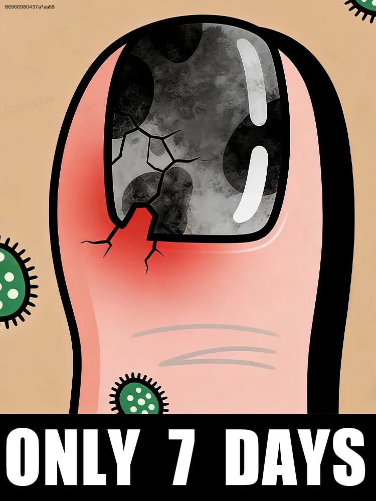 

Rapid penetrate, nails glassy-transparent,