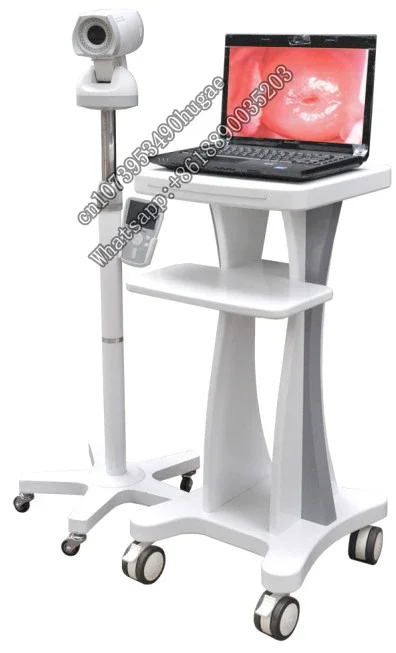 Video  With Tripod Gynecological Clinical Diagnostic Instruments