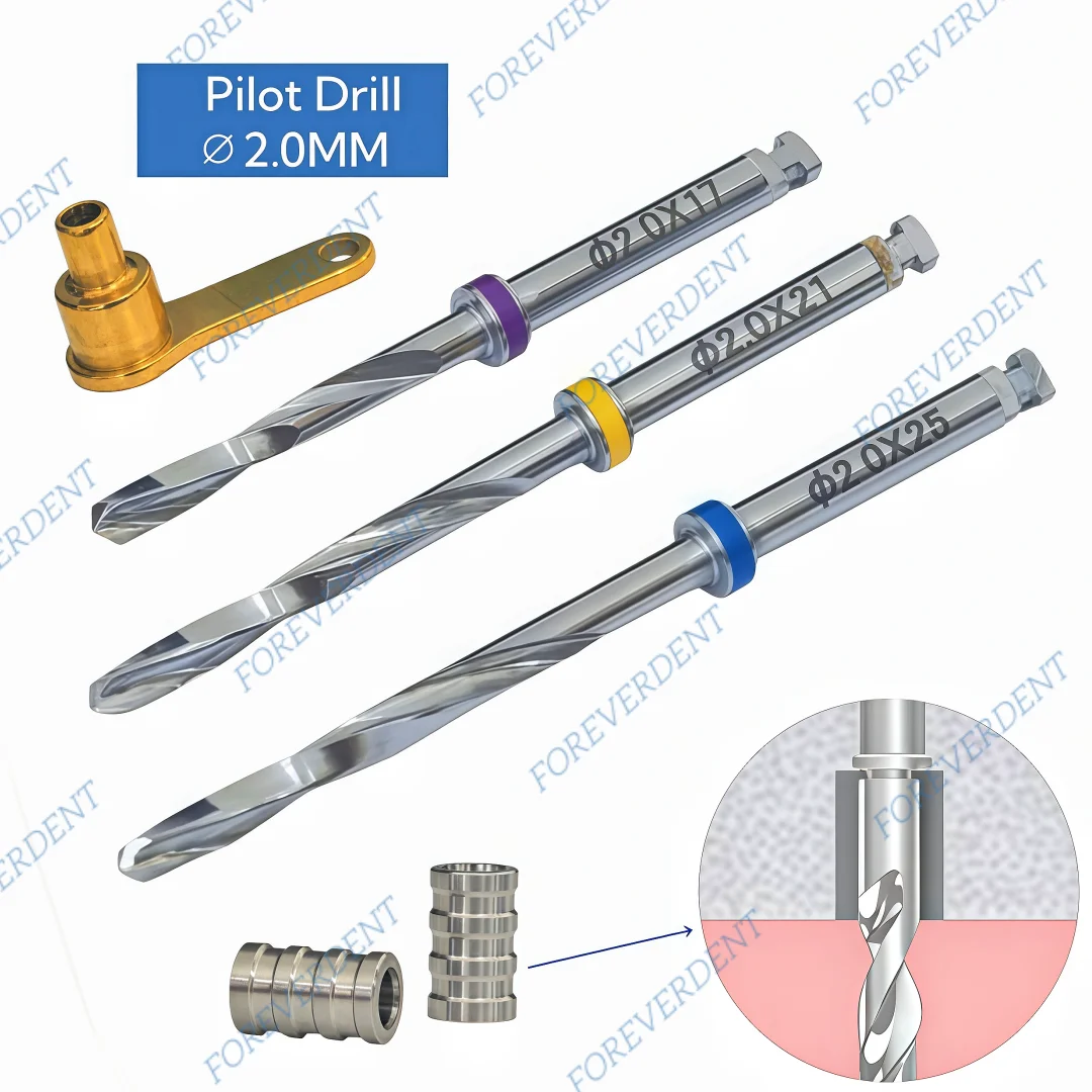 

New Dental Pilot Drills Slevees Implant Fixing Nail Guide Digital Jaw Drill Universal Slevees 3x2.0x5mm