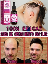 Óleo De Crescimento De Barba Para Homens, Produtos De Crescimento De Cabelo, Espessante, Nutritivo, Tratamento De Higiene, Cuidado De Barba