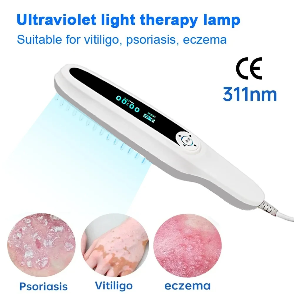 

UVB 311nm Phototherapy Lamp Laser Anti Vitiligo Psoriasis White Spot Vitiligo Treatment Ultraviolet Phototherapy Instrument Skin