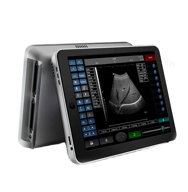 SY-A011 Portable Diagnostic Ultrasound system for hospital Laptop pet cat dog ultrasound scanner