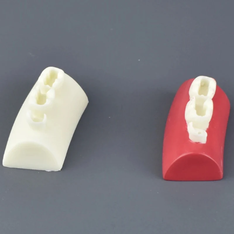 1 Stück Dental Inlay Übungs modell Block füllung Übung Typodont Harz Materialien Oral Filling Modell für Zahnmedizin Unterricht Stud