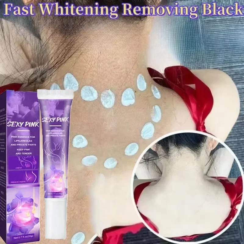 

Body Whitening Cream Private Parts Underarm Bleaching Serum Whiten Butt Knee Brighten Inner Thigh Intimate Cream