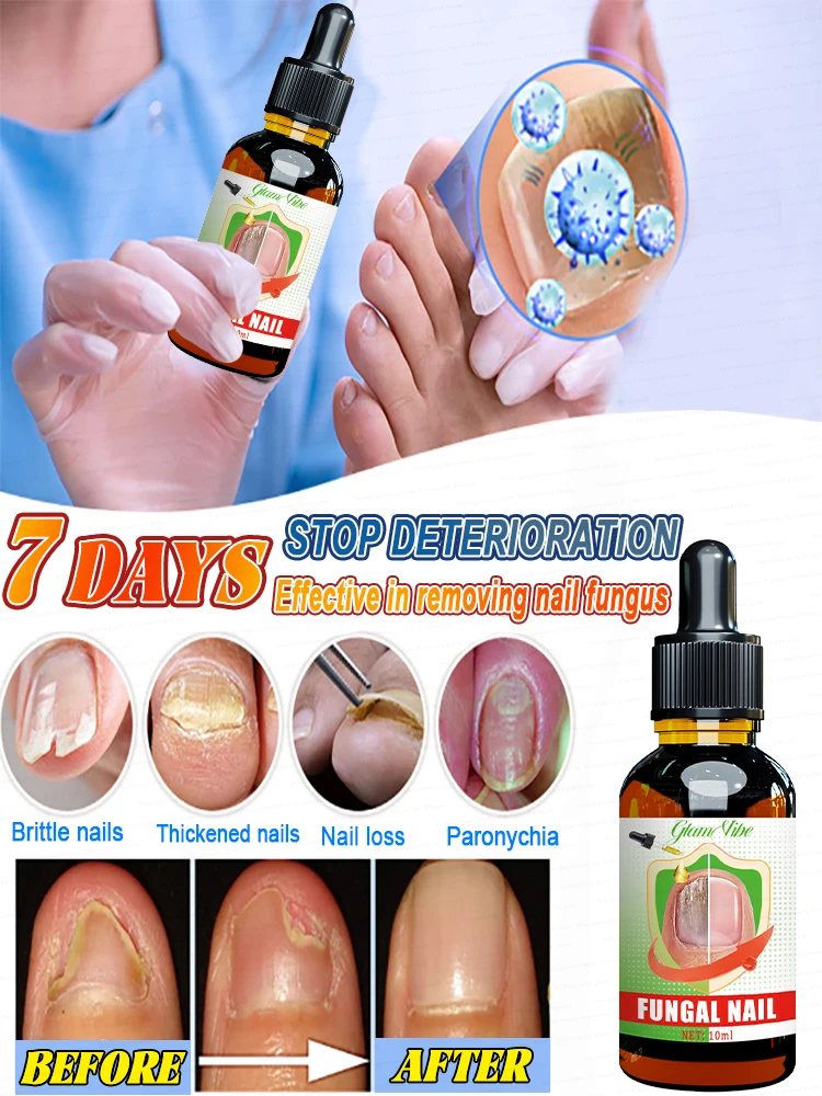 Essentials for solving nail problems, foot care