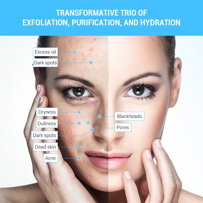 Alat Microdermabrasion berlian 3 IN 1, mesin Kecantikan berlian semprotan air hisap komedo alat pengelupasan kulit wajah