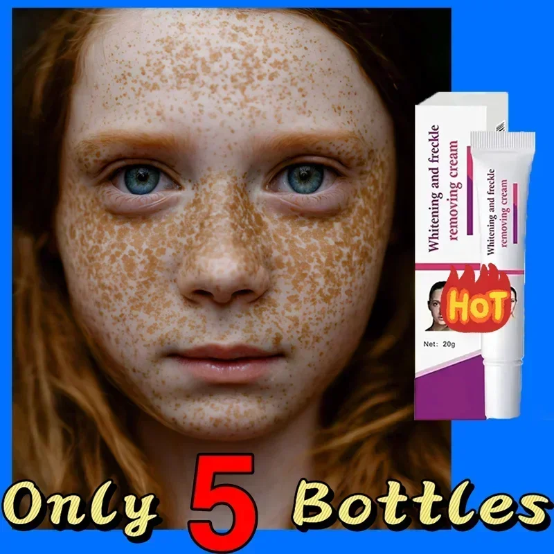 

FreckleWhiteningCreamBlackDotsMelasmaRemovalAntiBrownStainLightenPigmentationMoisturizingSkinCareProducts