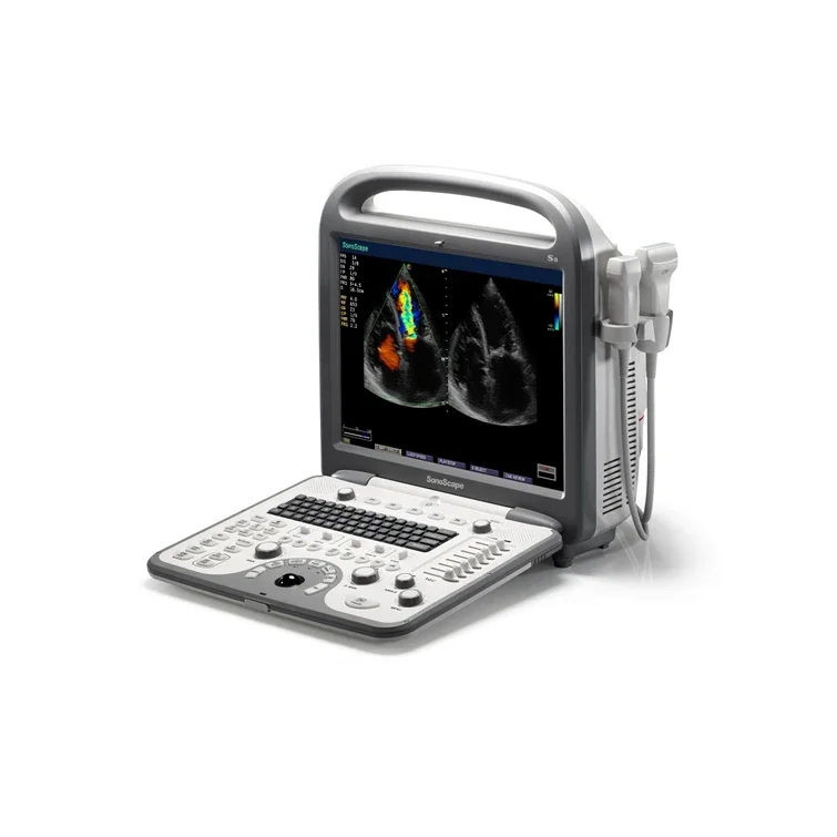 Human Software Sonoscape S8 4D Ultrasound Professional Tool For Outdoor And Hospital Use Color Flow