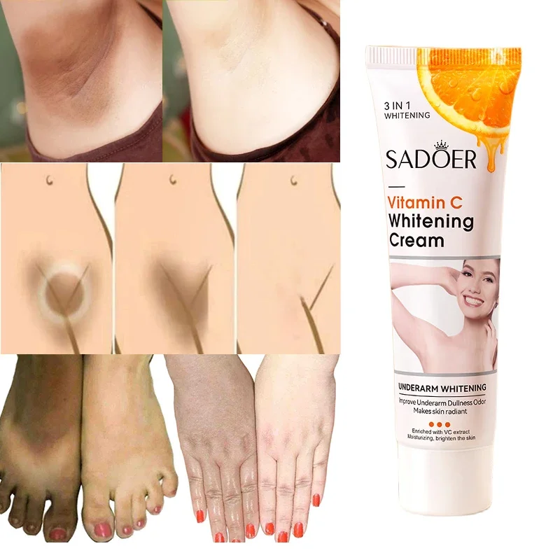 Crema iluminadora con vitamina C, blanqueador, melanina, zonas íntimas, blanqueamiento de piernas, rodillas, codos, brazos, ilumina la melanina