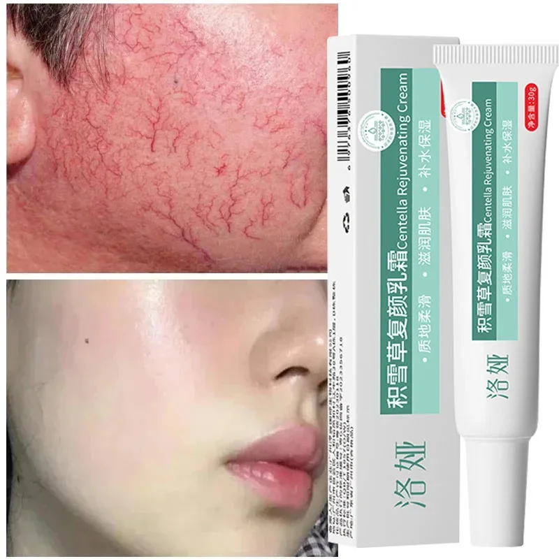 Instant Facial Redness Repair Cream Soothing Red Blood Rosacea Treatment Improve Sensitive Skin Anti Redness Skin Care Cosmetics