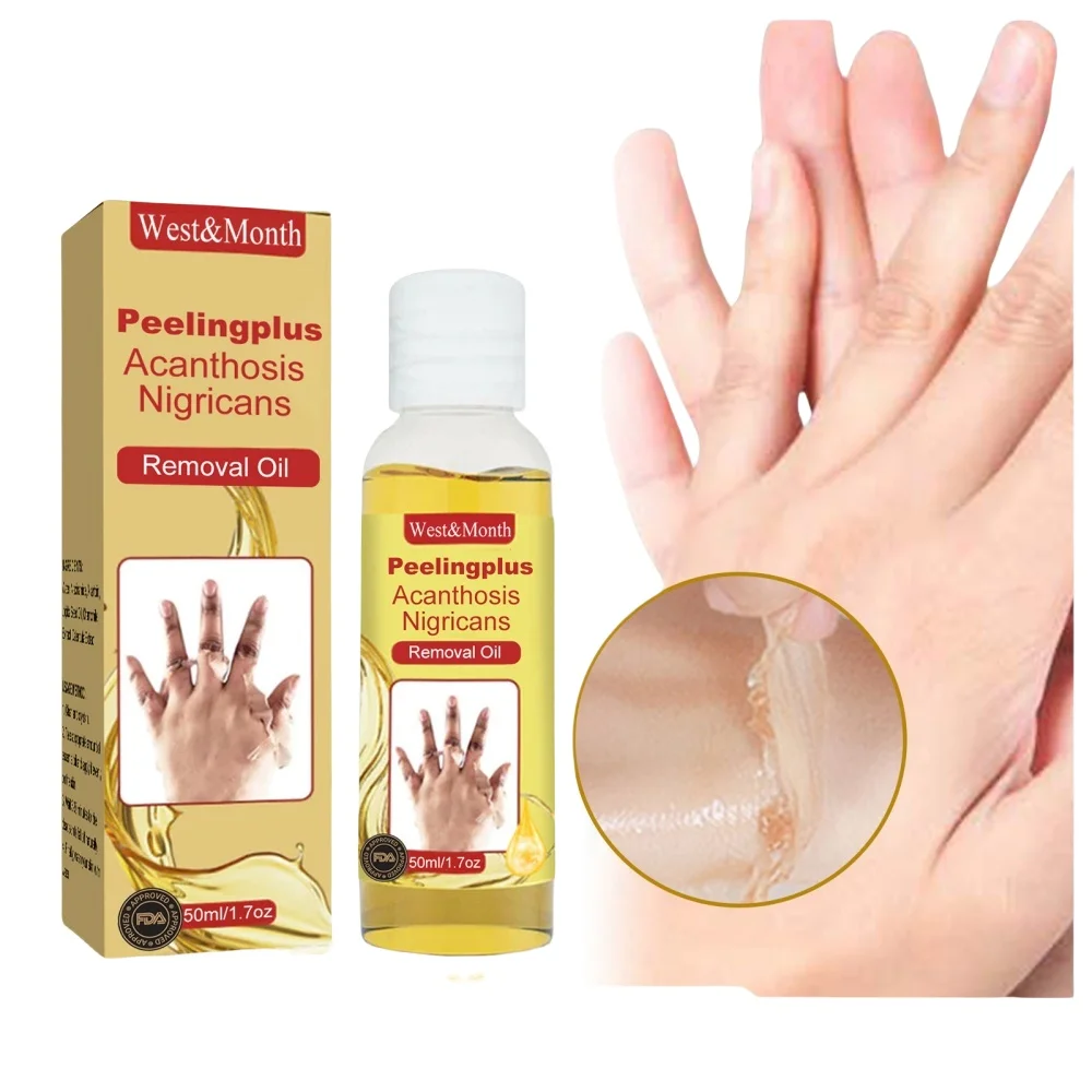 

Сделайте темную кожу, яркую и гладкую! Удаление омертвевшей кожи и отшелушивания локтей, коленей и косточек с отшелушивающим маслом и отбеливающим устройством.