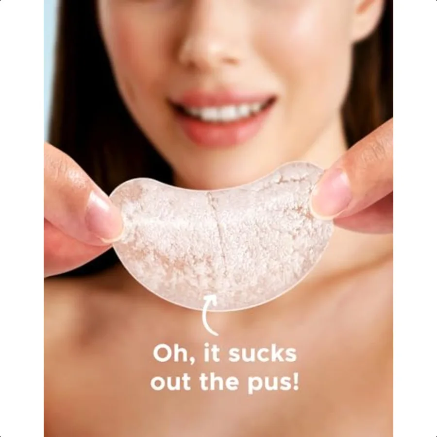 حب الشباب بثرة التصحيح 8 أحجام 140 قطعة بقع حب الشباب الغروانية المائية مع صندوق تخزين 24 XL بقع بثرة للوجه الذقن الأنف 4 أشكال Z #6