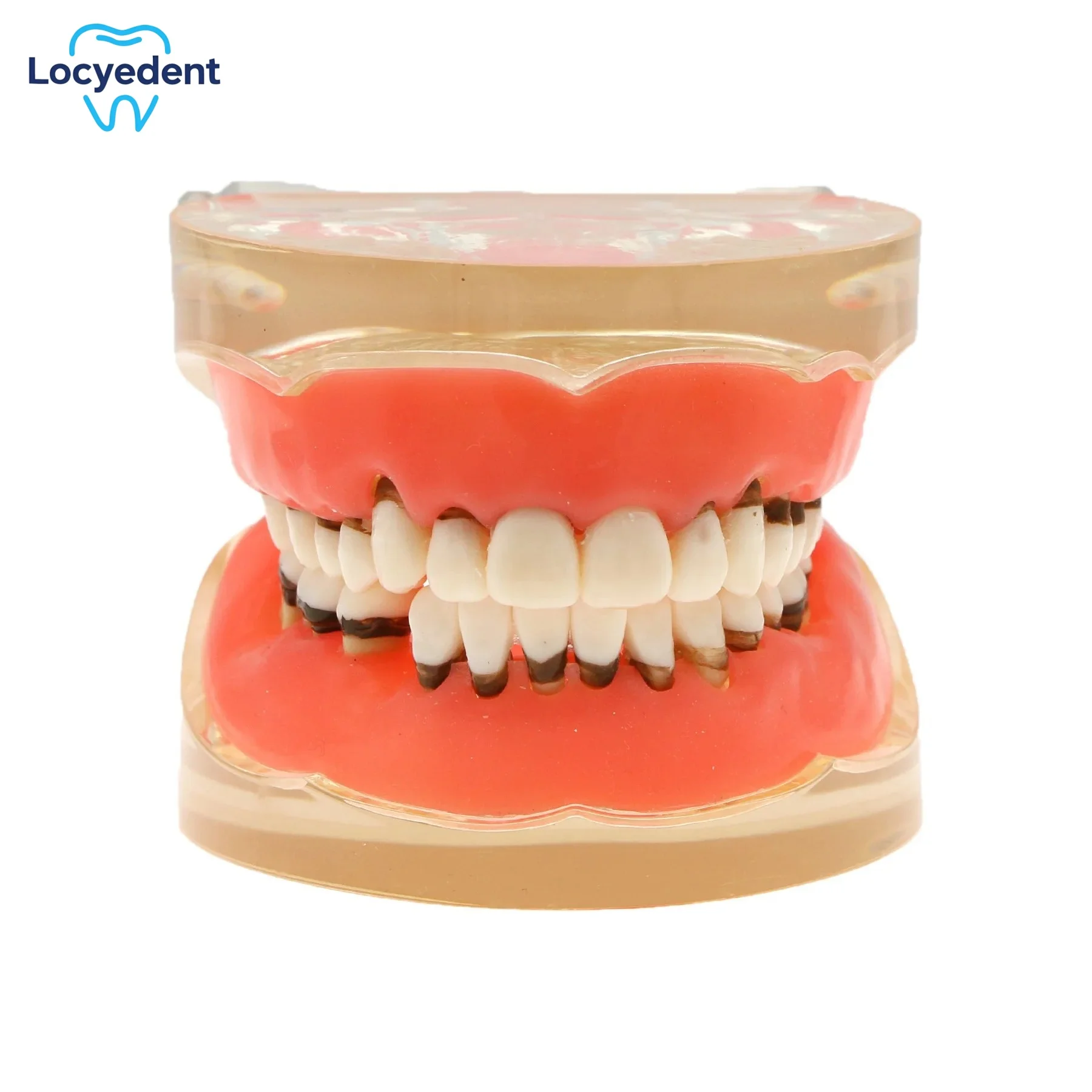 Dental Teeth Model M4017 Periodontal Disease Demonstration Tool for Patient Education And Dentist Teaching on Pathological Teeth